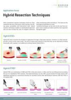 Application focus hybrid resection techniques wiht FTRD and RESECT+