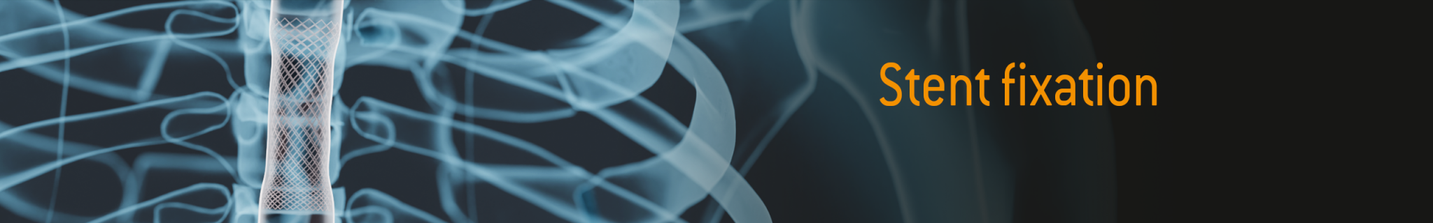 News_Banner_Stentfixierung-EN_2560x400px