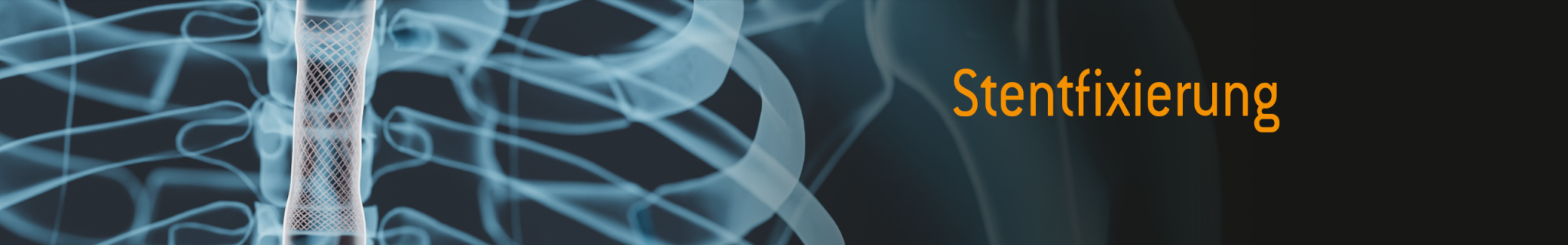 News_Banner_Stentfixierung_2560x400px