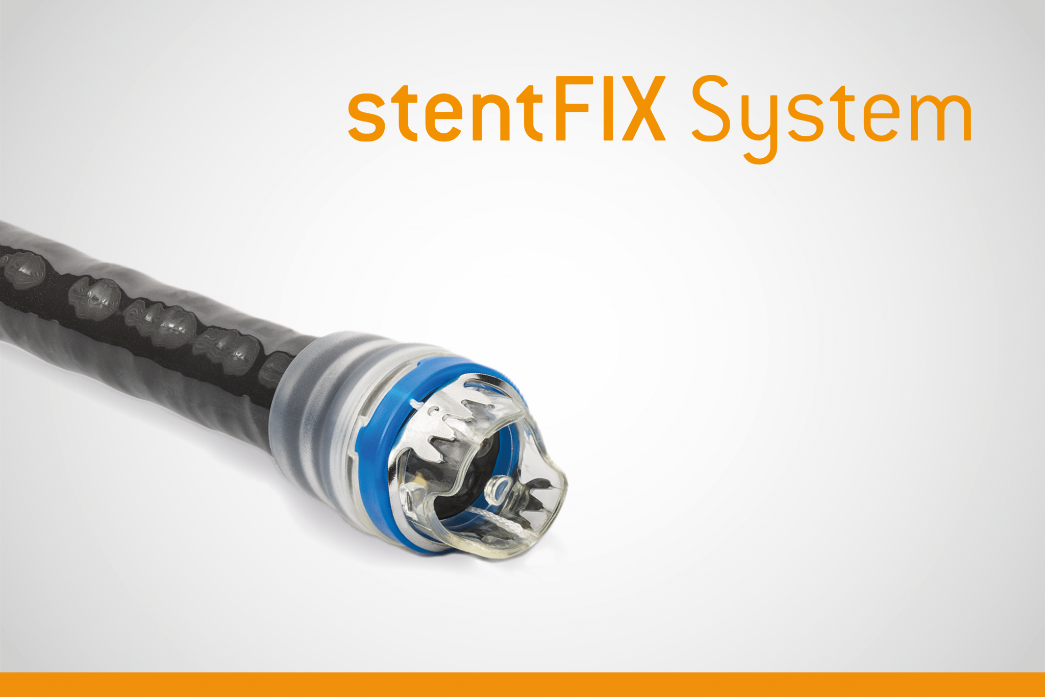 Produktübersicht_stentFIX System