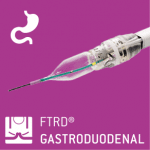 gastroduodenal FTRD® mounted on an endoscope enables endoscopic full-thickness resection in the stomach and duodenum Ovesco Endoscopy